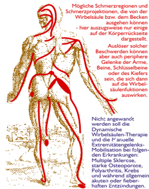 Wirbelsäulen-Therapie